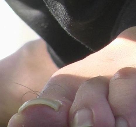女性の足の親指に生えた毛
