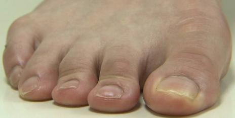 女性の足指ドアップ画像